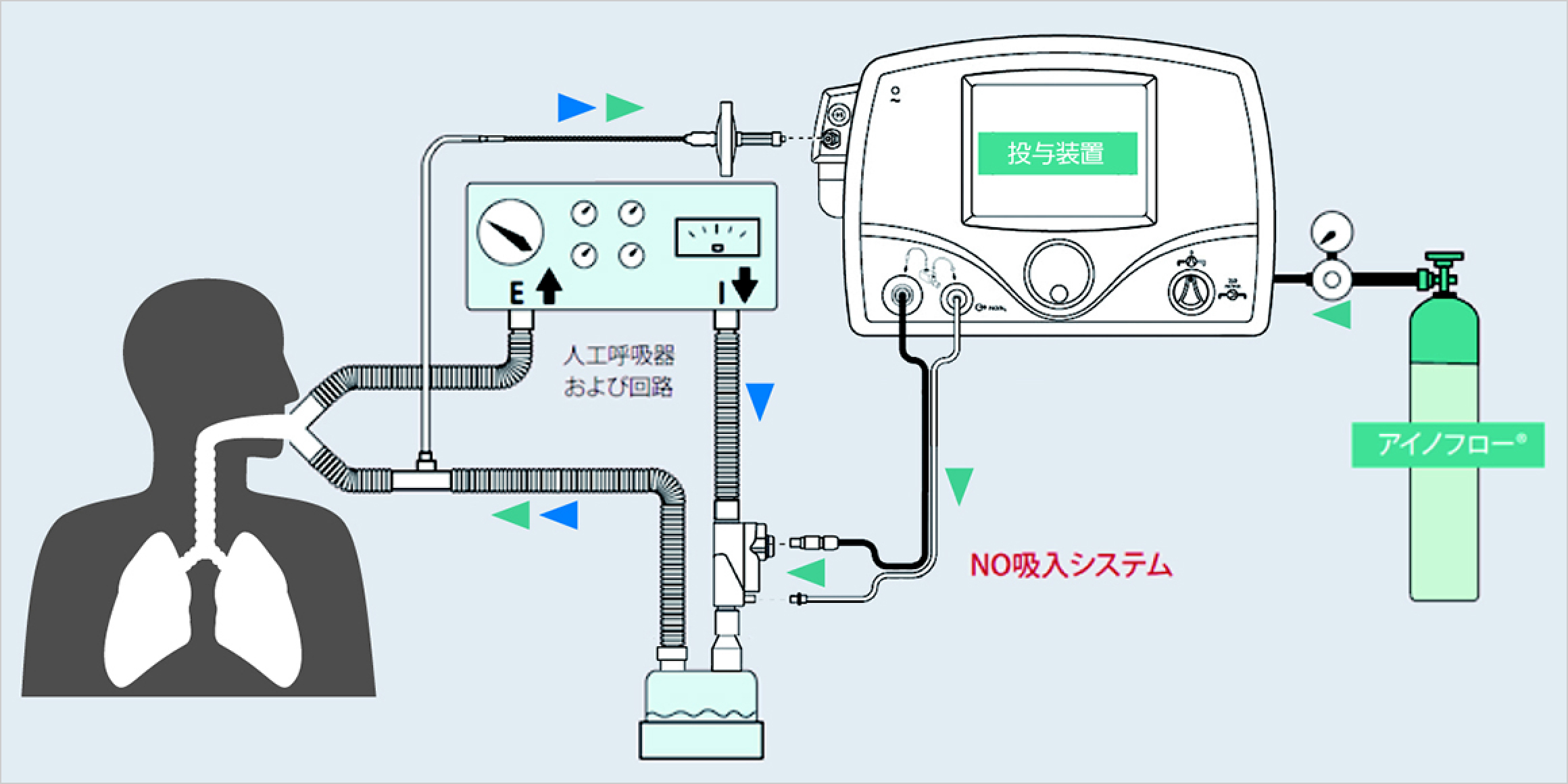 一酸化窒素ガス管理システム